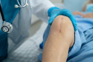Como acelerar o processo de cicatrização após a cirurgia?